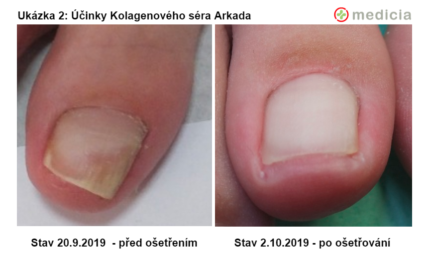 Z praxe Podiatrického centra Medicia 2